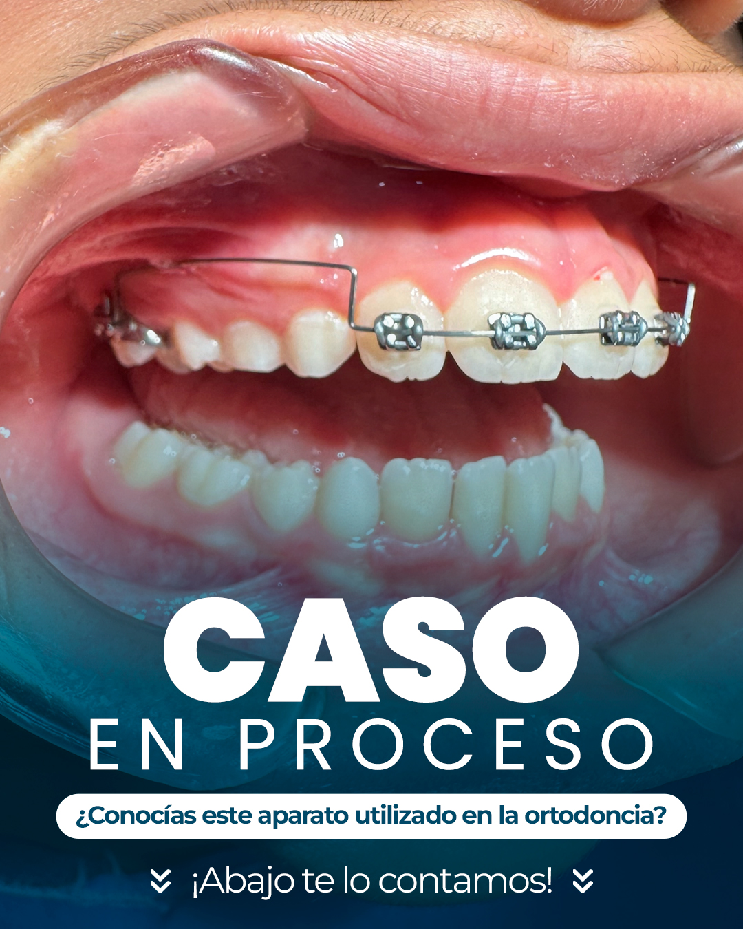 Diseno Rrss Dr Javier Lopez2